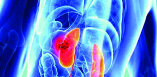 দেশে প্রথমবারের মতো মৃত কোনো মানুষের দেহ থেকে নেওয়া কিডনি অন্যজনের দেহে সফলভাবে প্রতিস্থাপনের (ক্যাডাভেরিক ট্রান্সপ্লান্ট) সক্ষমতা অর্জন করলো বাংলাদেশ।